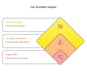Infographic showing car accident impact stages including vehicle crumple, occupant movement, and organ shift.